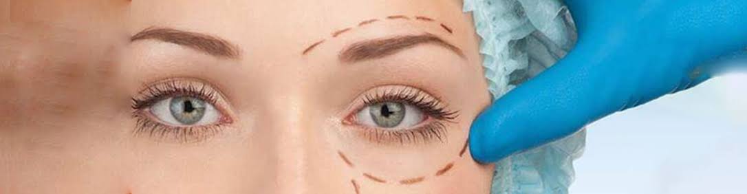 Oculoplasty services